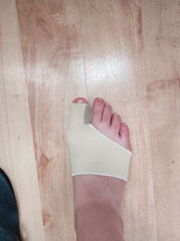 Walksy razdvajači za ispravljanje i korekciju nožnih prstiju